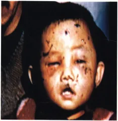 一个孩子死里逃生的58天2