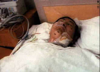 伤痛本该避免1