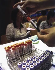 “艾滋病扎针”的真实与谎言