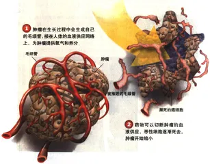 饿死癌细胞 　　