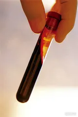 好消息·坏消息（599）4