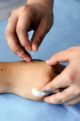 ​针灸医生的中国式生存1