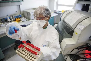 抗体检测：新冠疫情的热门话题1