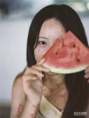镜头下，三个身体的故事3