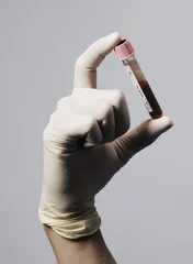 想要宝宝就少吃薯条2