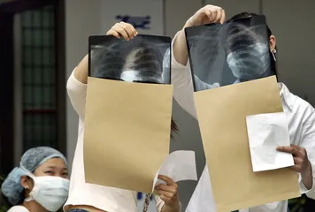 SARS病毒未解之谜2